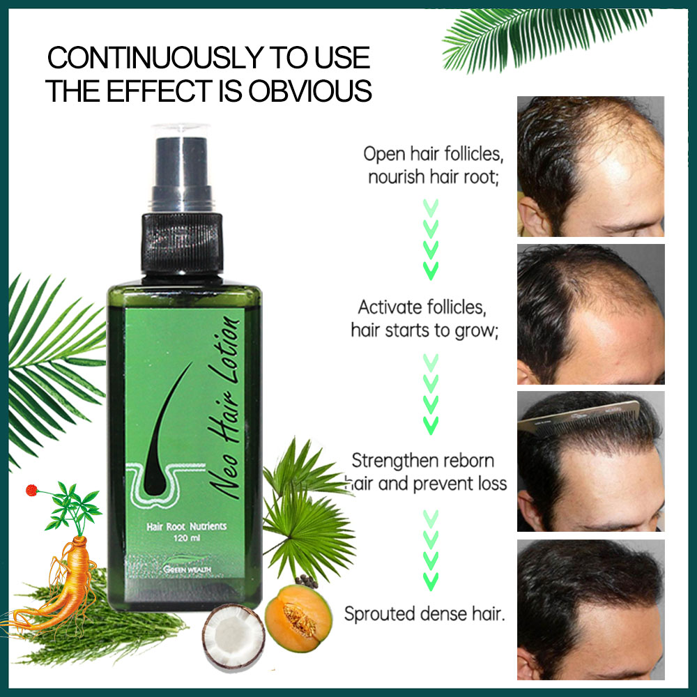 Loção capilar neo original 120 - Hair Care Thailand avaliação e preço